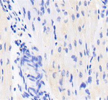 NT-proBNP（38-44）單抗